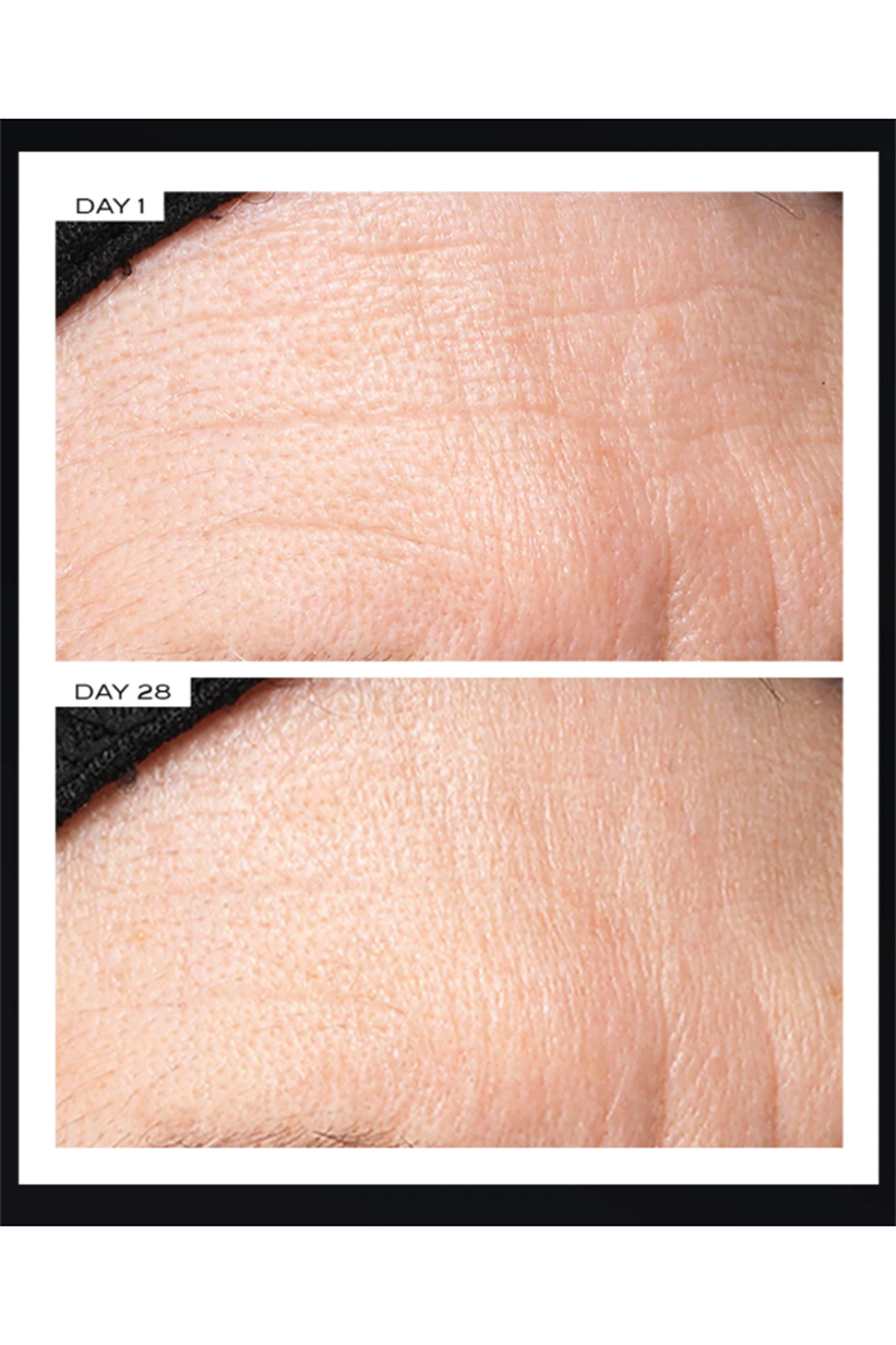 Exosome At-Home Face Lift Protocol