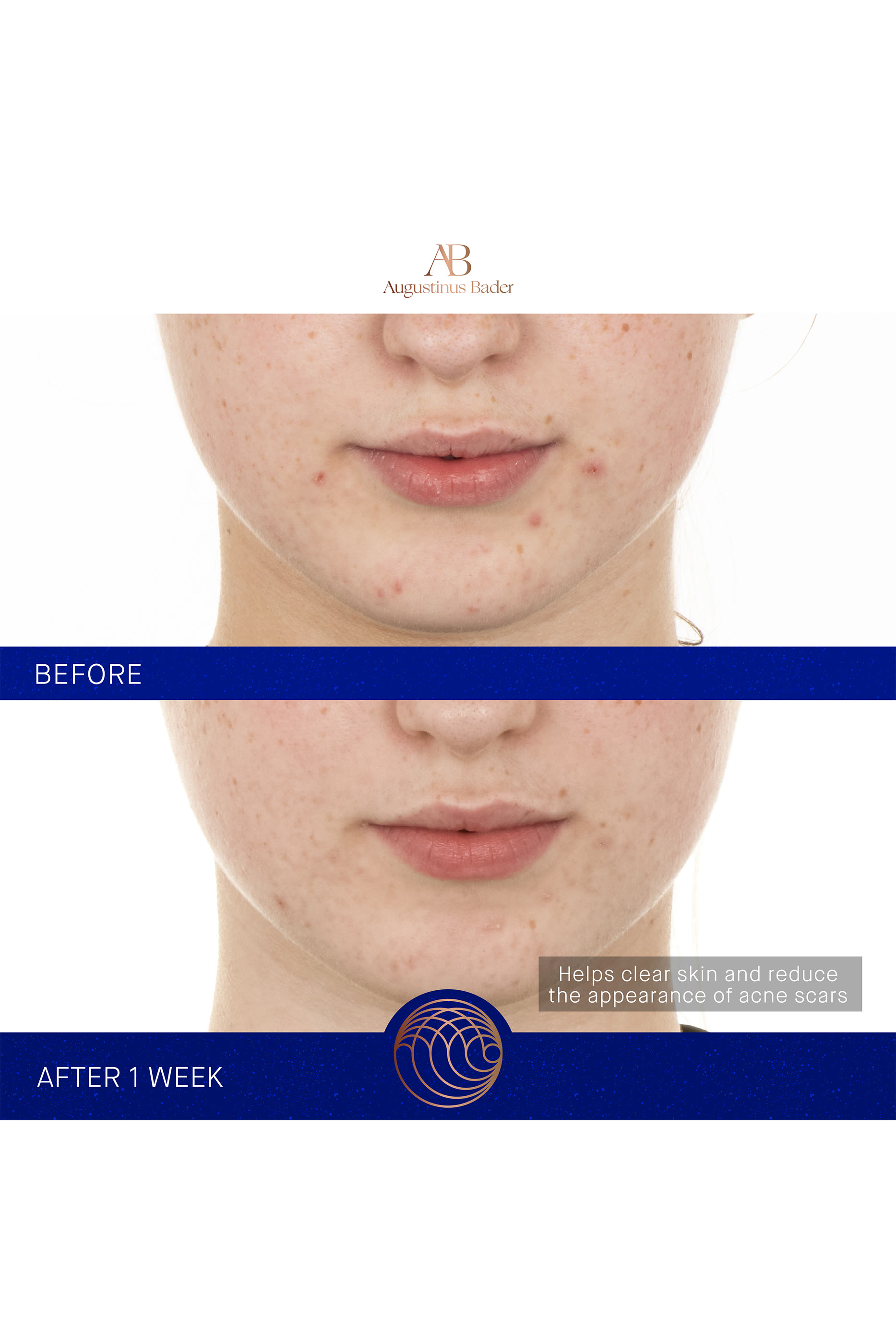 The Retinol Serum