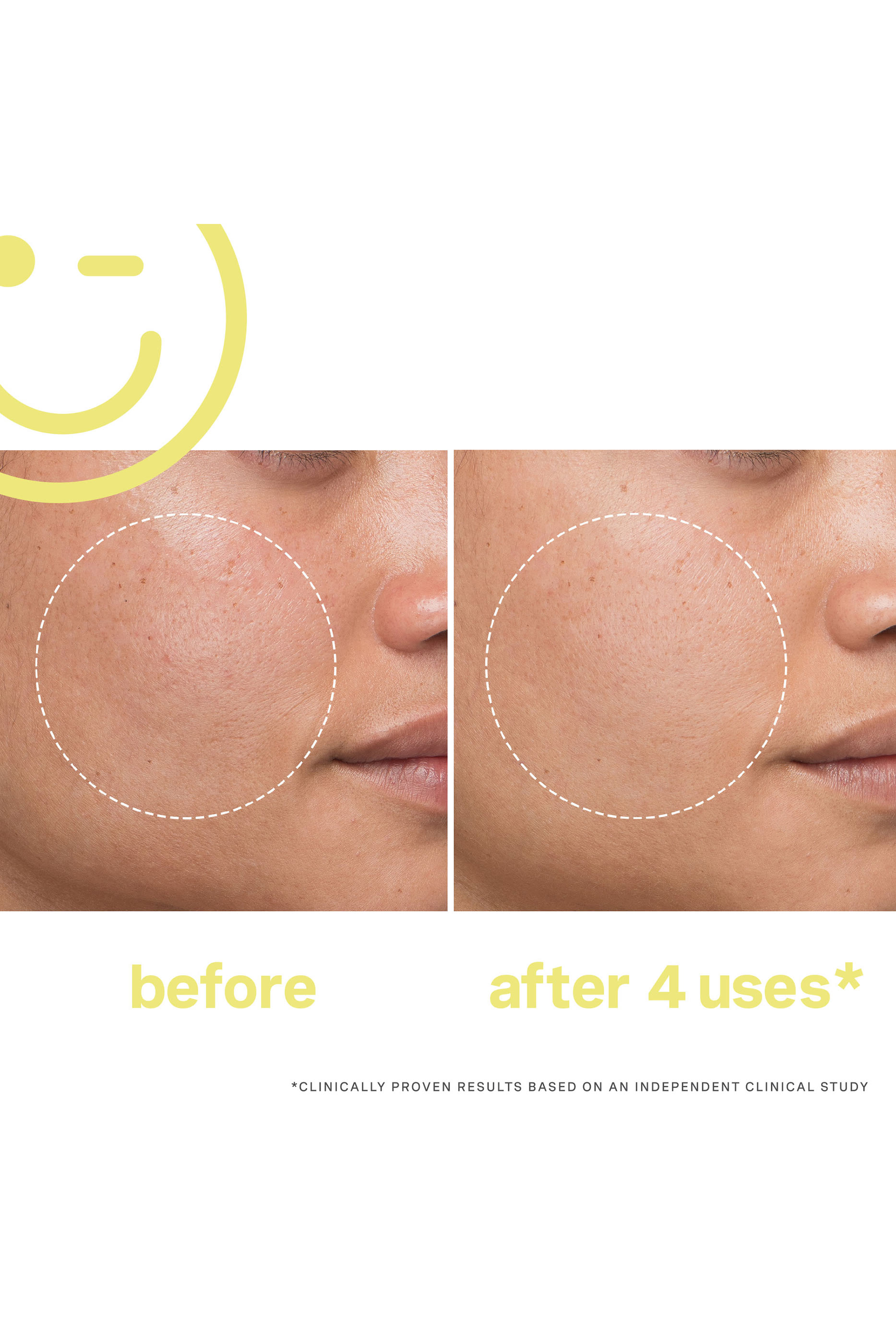 MEGA-C&trade; 30% Vitamin C Brightening Facial