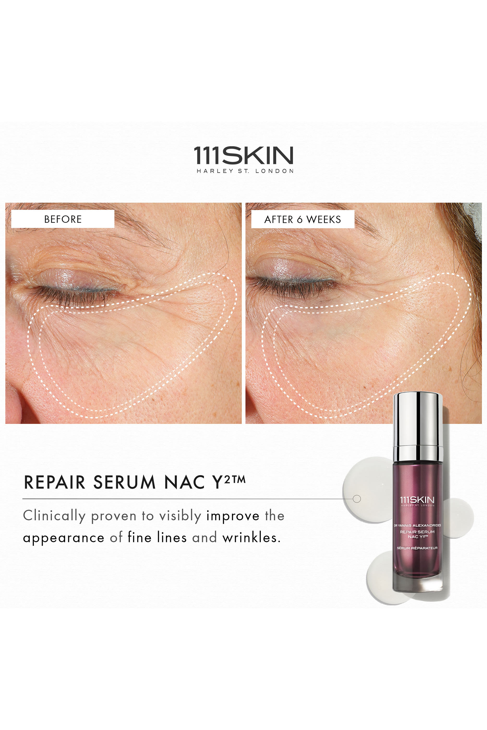 Repair Serum NAC Y2