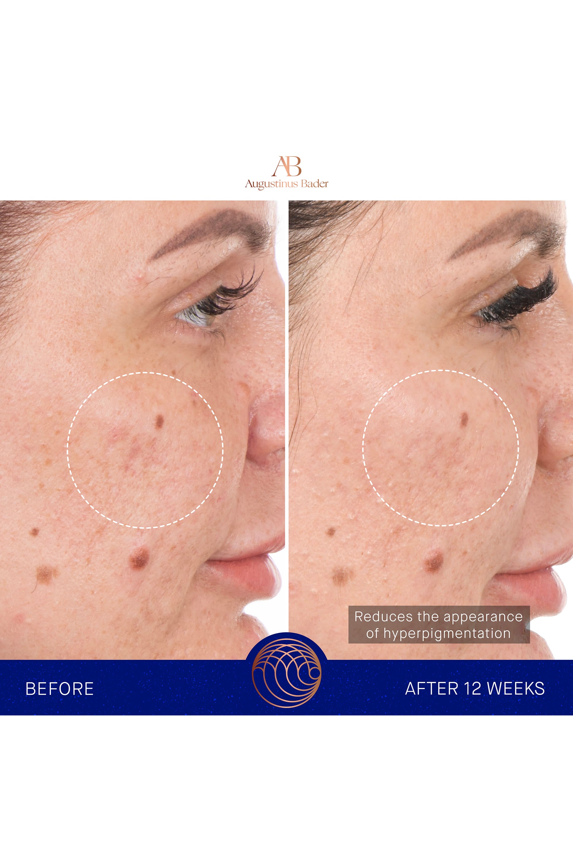 The Retinol Serum