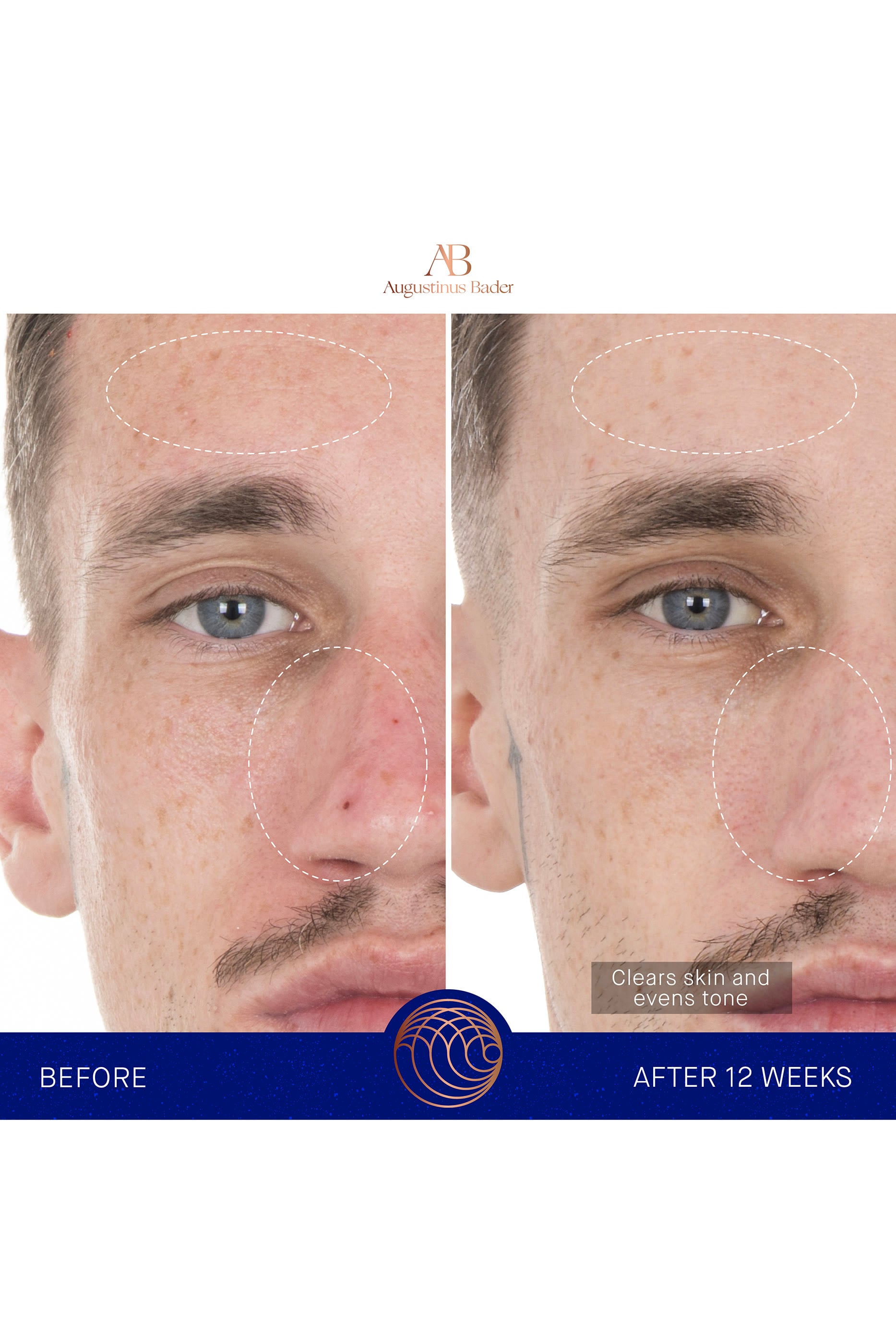 The Retinol Serum