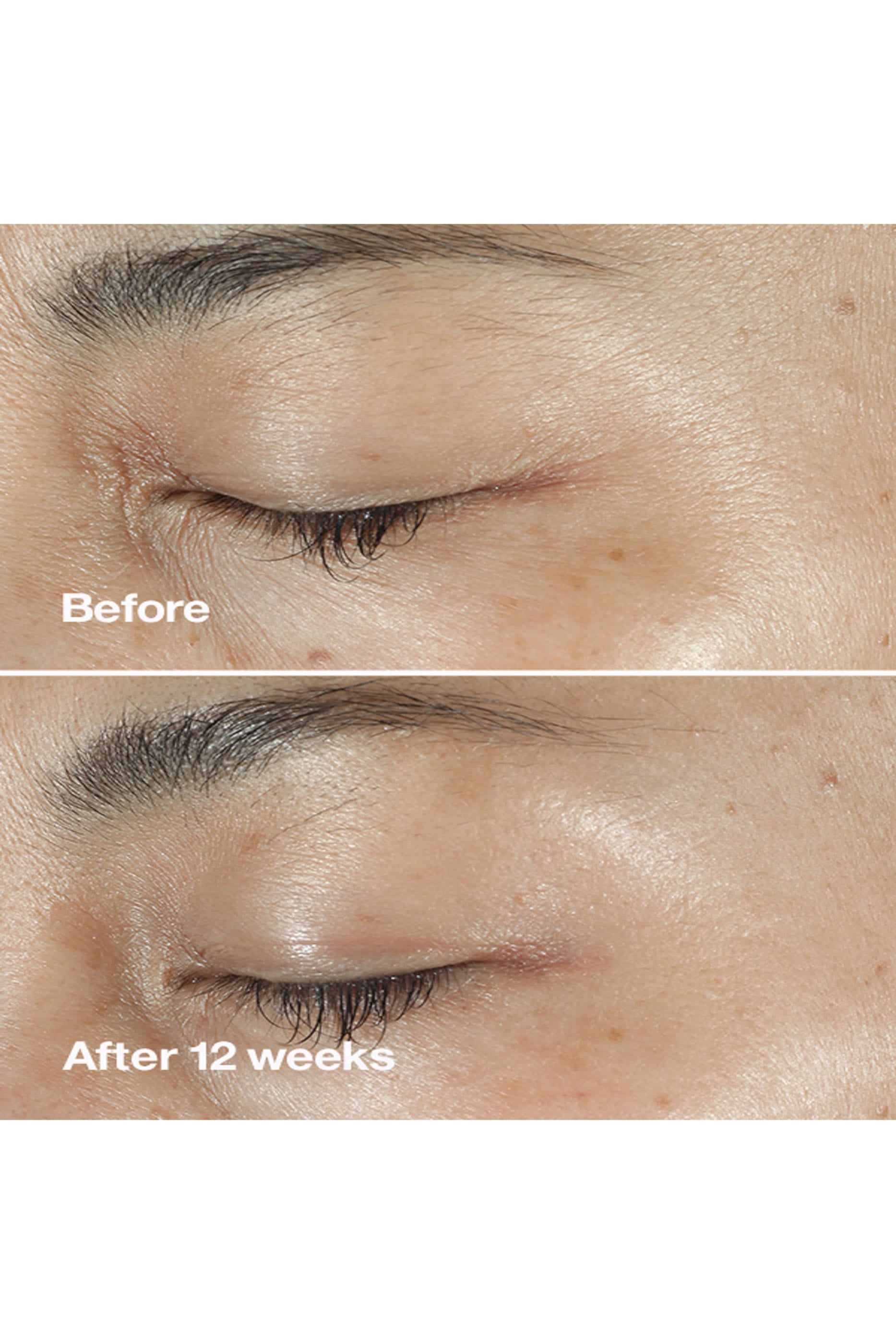 Smart Clinical Repair™ Wrinkle Correcting Serum