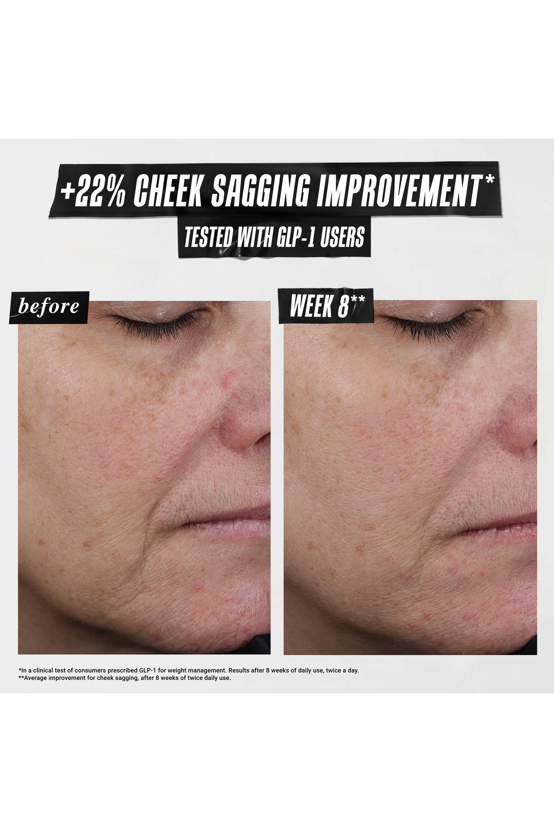 1cc* CollaShot Plumping Serum