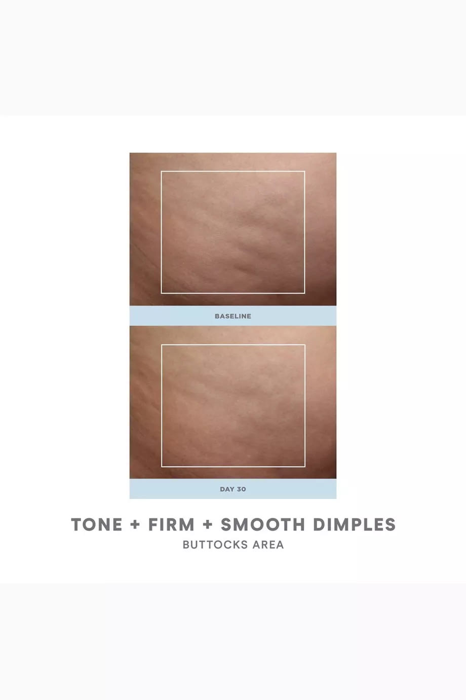 Nubody Skin Toning Device