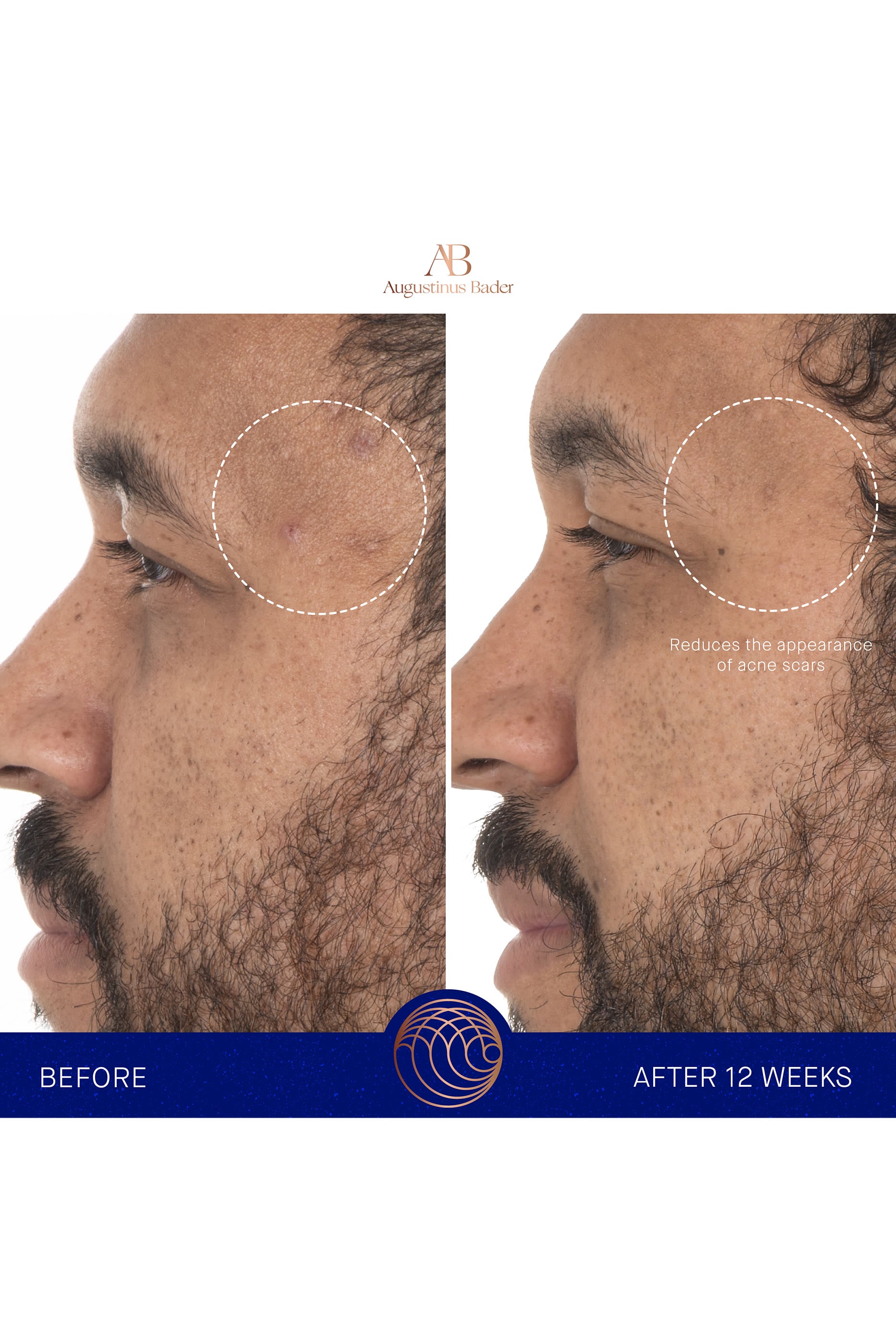 The Retinol Serum
