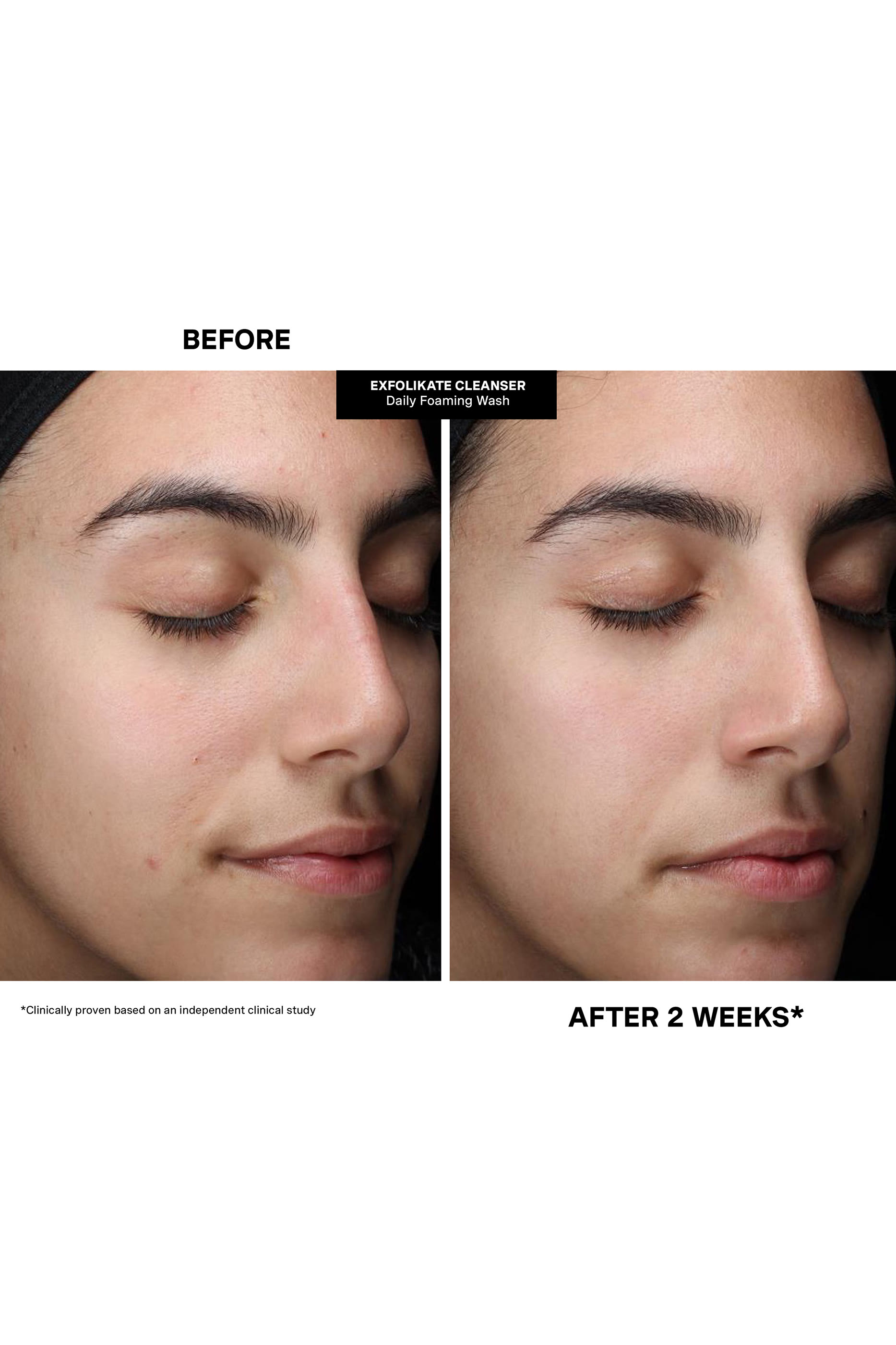 Pore-fect Holiday Trio Kit