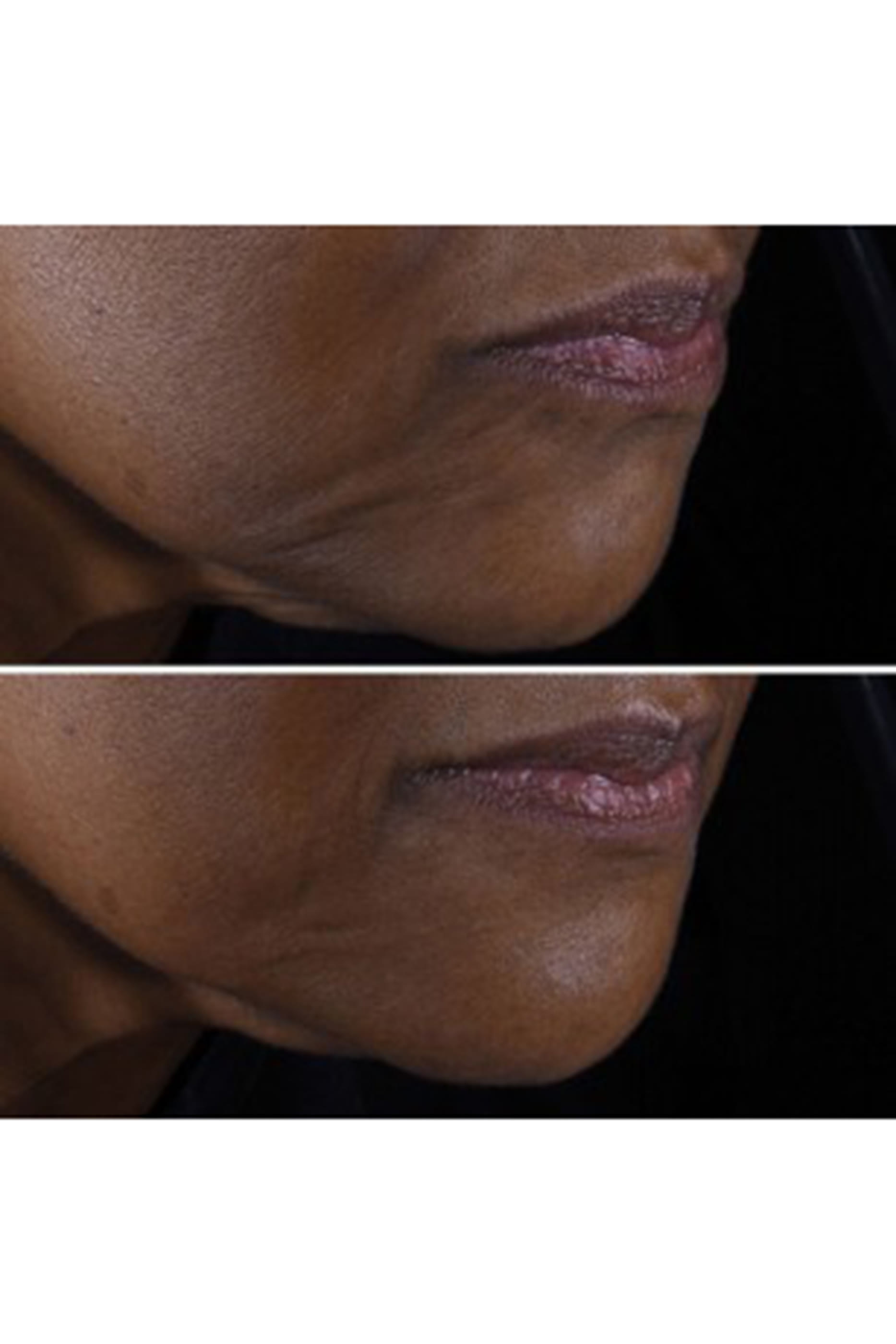 Outsmart Lines + Wrinkles: Smart Clinical Repair Set, 32% Value Savings