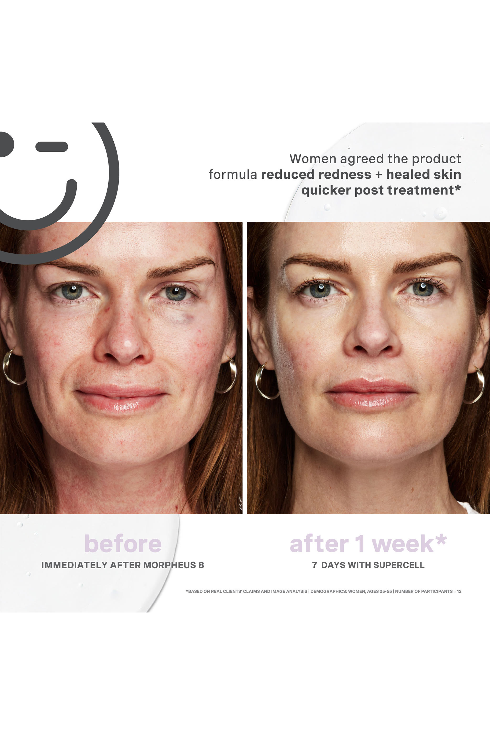 KateCeuticals SuperCell Rejuvenation Serum